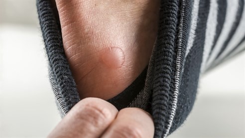 Chiropody and podiatry services in Bedfordshire