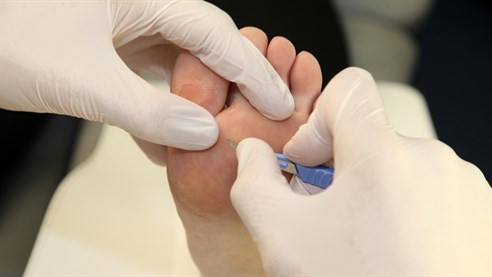 Chiropody and podiatry services in Bedfordshire